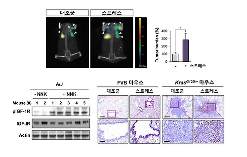 스트레스에 노출된 쥐의 폐 조직에서 종양이 증가한 모습